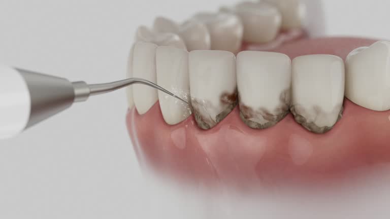 Trusted Tooth Extraction service in Lafayette, TN - Dentist Open Now